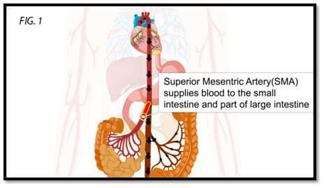 endovascular-surgery-1