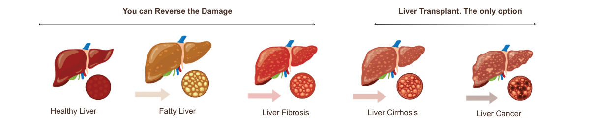 Liver Health Banner